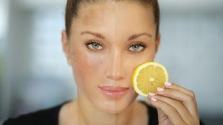 Dark spots hyperpigmentation before after result with lemon vitamin c