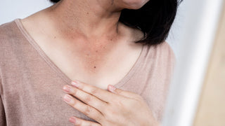 Sun damage on woman's skin in mirror