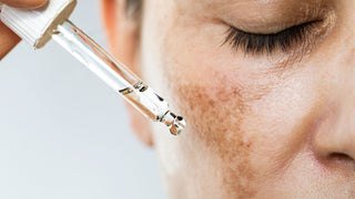Woman with hyperpigmented skin applying serum on face