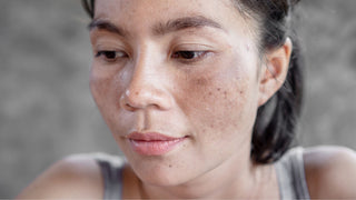 Woman with sun damaged skin